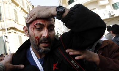 AP photographer Khalil Hamra is injured in Tahrir Square on Thursday. (AP Photo/Mohammed Abed)