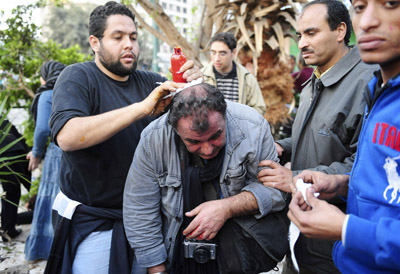 SIPA Press agency photojournalist Alfred Yaghobzadeh is treated by anti-government protesters after being wounded during clashes in Cairo. (AP)