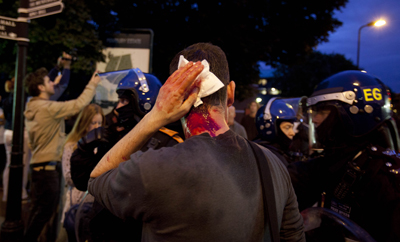 A photographer holds his head after he was attacked by protesters in east London on Monday. (AP/Karel Prinsloo)
