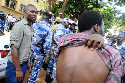 Anatoli Luswata shows injuries from a police beating. (AFP)