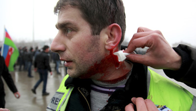 Journalist Rashid Aliyev was injured in clashes between protesters and police in the city of Quba yesterday. (Reuters/Abbas Atilay)