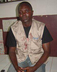 Atayi Ayi, after the attack. (AFreePress)