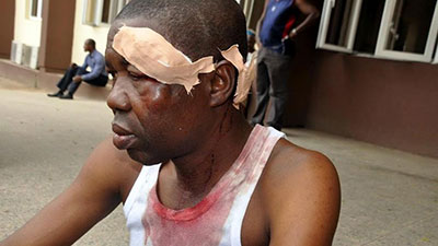 Benedict Uwalaka after his attack. (Premium Times)