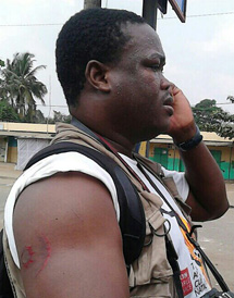 Freelance journalist Noel Kokou Tadegnon was assaulted at Thursday's protest. (Courtesy Noel Kokou Tadegnon)