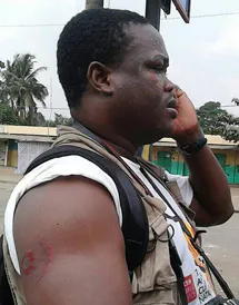 Freelance journalist Noel Kokou Tadegnon was assaulted at Thursday's protest. (Courtesy Noel Kokou Tadegnon)