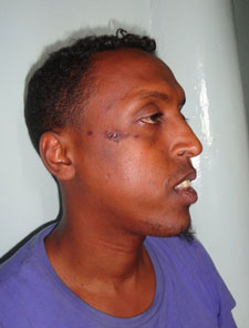 Mohamed Barre after detention (SIMHA)