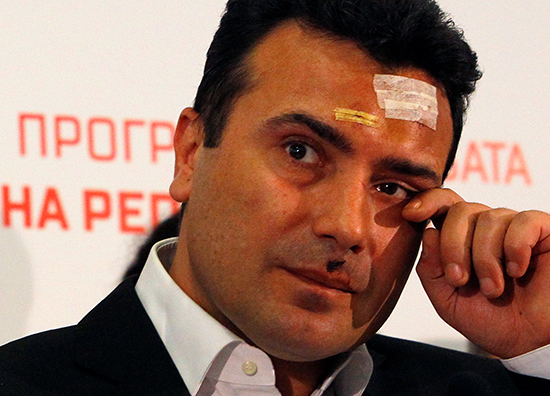 Macedonian Social Democratic Party leader Zoran Zaev, who was among those injured when protesters stormed the parliament on April 27, 2017, reacts at a news conference in Skopje the following day. (Reuters/Ognen Teofilovski)
