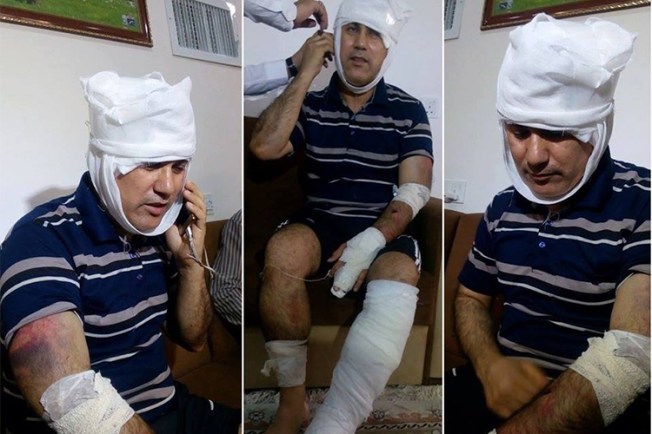 Ibrahim Abbas recovers after five men beat him in Amman on July 10, 2017. (Aso Abbas)