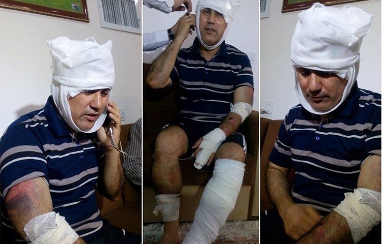Ibrahim Abbas recovers after five men beat him in Amman on July 10, 2017. (Aso Abbas)