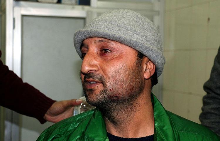 Photojournalist Nisar ul Haq, who was among four journalists injured by pellet-gun fire from Indian security forces on January 22, 2019. (Photo courtesy of Nisar ul Haq)