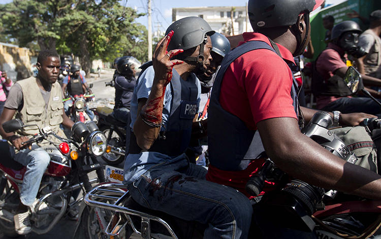 Un journaliste de Reuters, Robenson Sanon, soulève son bras, couvert de sang, après avoir été touché par balle lorsqu'il documentait les affrontements entre la police nationale et les manifestants près du palais présidentiel à Port-au-Prince en Haïti le 13 février 2019. (God Nalio Chery / AP)