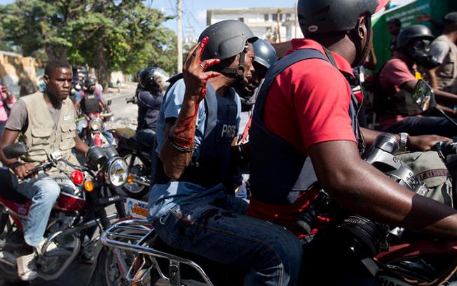 Reuters journalist Robenson Sanon holds up his blood covered arm, after he was shot while documenting clashes between national police and protesters near the presidential palace in Port-au-Prince, Haiti, on February 13, 2019. (Dieu Nalio Chery/AP)
