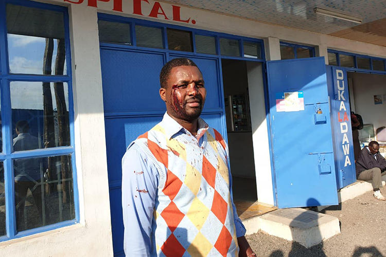 Kenya Television Network cameraman Bonface Kirera Magana is seen outside a hospital in Kyumbi, Machakos county, where he and other journalists went to receive treatment after they were attacked at a local high school. (Image via Standard Group, used with permission)
