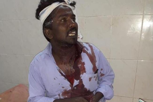 Journalist G. Muthuvel is seen following the attack against him on June 19, 2019. (Image via The News Minute, used with permission)