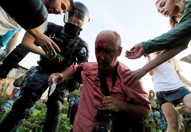 People help a wounded man during a rally calling for opposition candidates to be registered for elections to the Moscow City Duma, the capital's regional parliament, in Moscow, Russia, on July 27, 2019. Police in Moscow attacked, threatened, and detained journalists covering protests in Moscow on July 27 and August 3. (Reuters/Tatyana Makeyeva)