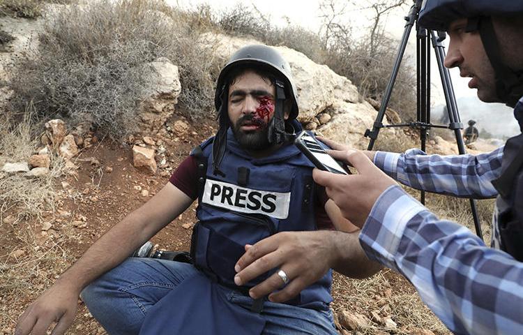 Palestinian photographer Moath Amarneh is seen after being hit with shrapnel from a rubber bullet fired by Israeli security forces in Surif, the West Bank, on November 15, 2019. (AFP/Hazem Bader)