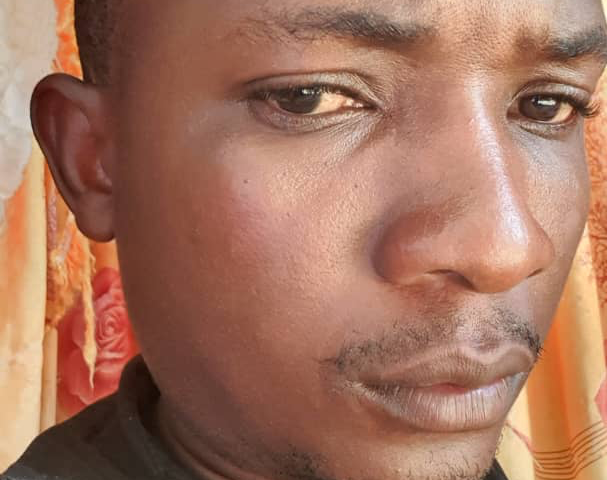 Journalist Lucien Lyenda's face became swollen after soldiers hit him with rifle butts as he was reporting on a demonstration about insecurity in the southeastern town of Kirungu in the Democratic Republic of Congo.