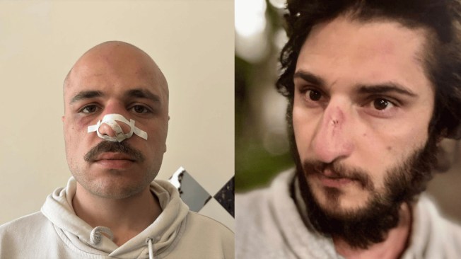Giorgi Baskhajauri (left) and Nurlan Gahramanli (right) are two of at least four journalist who were assaulted while covering protests against Georgia's "On Transparency of Foreign Influence” bill. (Photos: Courtesy of Giorgi Baskhajauri and Nurlan Gahramanli)