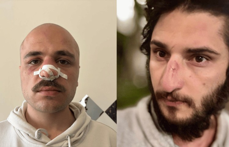 Giorgi Baskhajauri (left) and Nurlan Gahramanli (right) are two of at least four journalist who were assaulted while covering protests against Georgia's "On Transparency of Foreign Influence” bill. (Photos: Courtesy of Giorgi Baskhajauri and Nurlan Gahramanli)