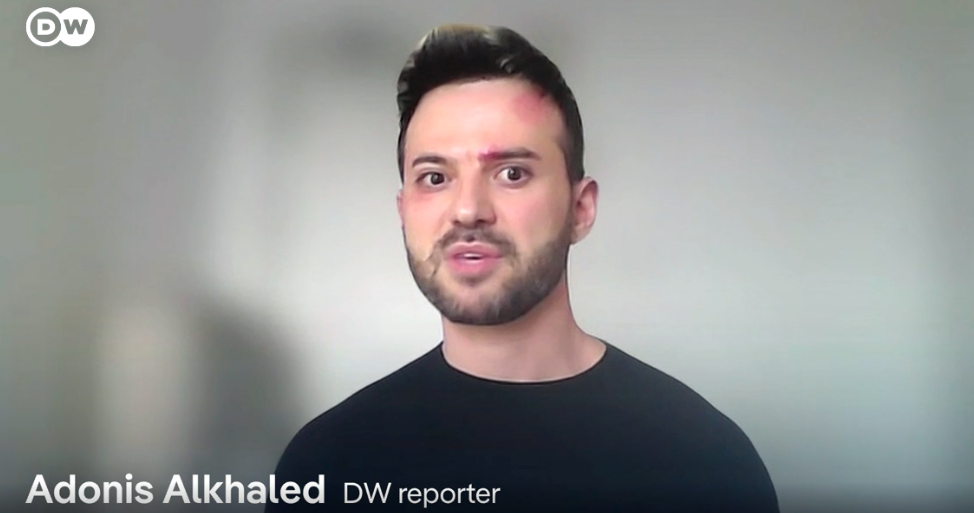 Adonis Alkhaled DW