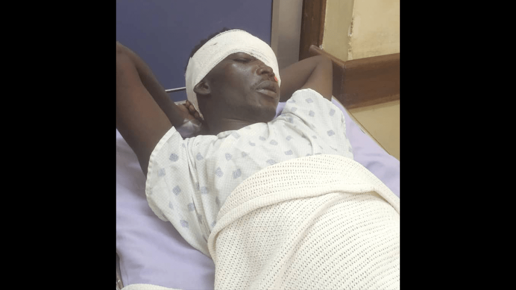 Ugandan journalist Ibrahim Miracle is treated at St. Francis Hospital Nsambya in the capital, Kampala, on February 26 after two security officers assaulted him while he was reporting. (Photo: Courtesy of Livingstone Matovu)