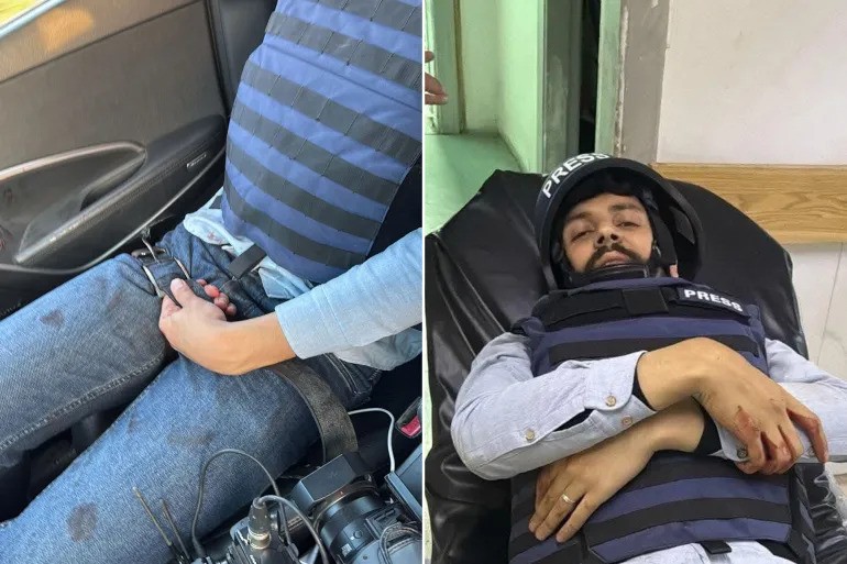 Al Jazeera camera operator Ryad Alhussein holds a makeshift tourniquet around his right thigh after being shot while covering clashes near Jableh on Syria’s west coast on March 6, 2025.