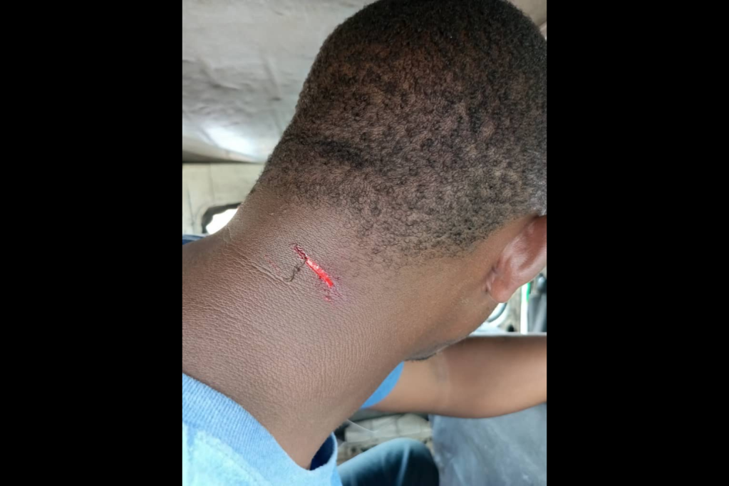 Wave FM Zambia journalist Hope Chooma was attacked by ruling United Party for National Development (UPND) supporters while covering a charity event in the southern town of Mazabuka.