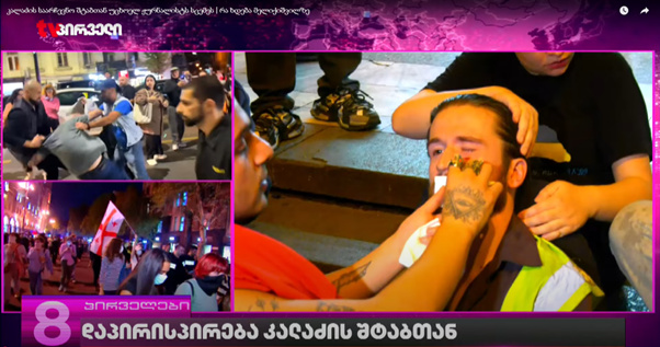 Hungarian journalist László Mézes receives medical treatment for a cut to his face (right) amid scenes of violent clashes in the Georgian capital Tblisi on September 8, 2025.