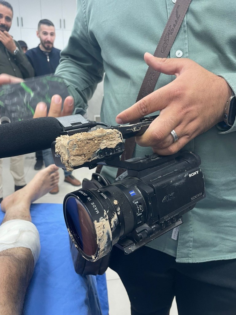 Yassen's camera after he was shot in both legs.