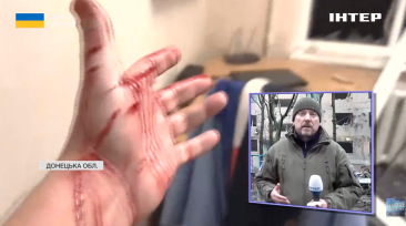 Igor Levinok, a war correspondent with the privately owned Ukrainian TV channel Inter, was injured by a Russian bomb on February 8.