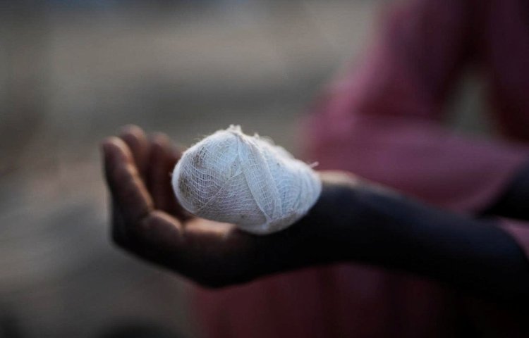 A child shows an injured hand at a camp for displaced people who fled from al-Fashir to Tawila, North Darfur, Sudan, on October 27, 2025.